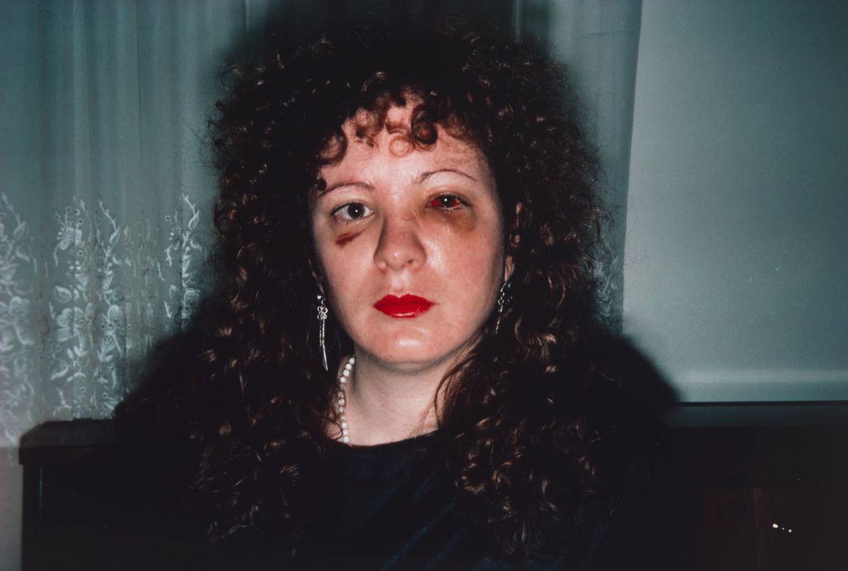 Cibachrome colour photograph self portrait of a woman's face after assault
